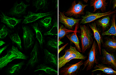 Anti-Cytokeratin 7 antibody [HL6074] used in Immunocytochemistry/ Immunofluorescence (ICC/IF). GTX648153