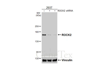 Anti-ROCK2 antibody [HL6078] used in Western Blot (WB). GTX648157