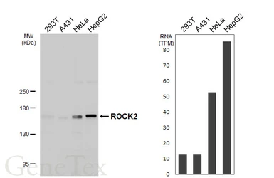 Anti-ROCK2 antibody [HL6079] used in Western Blot (WB). GTX648158