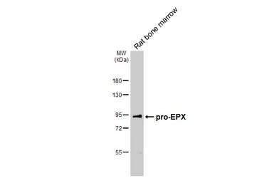 Anti-EPX antibody [HL6084] used in Western Blot (WB). GTX648163