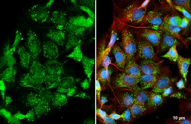 Anti-BMP4 antibody [HL6085] used in Immunocytochemistry/ Immunofluorescence (ICC/IF). GTX648170