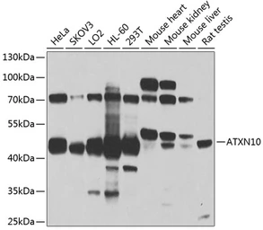 Anti-ATXN10 antibody used in Western Blot (WB). GTX64818