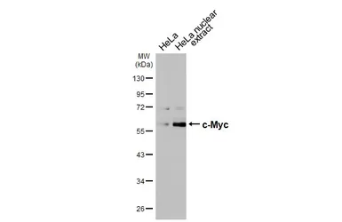 Anti-c-Myc antibody [HL6095] used in Western Blot (WB). GTX648180