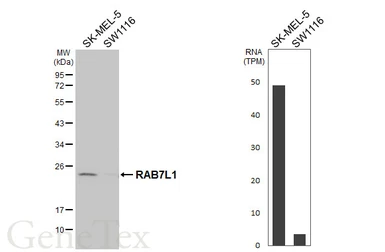 Anti-RAB7L1 antibody [HL6105] used in Western Blot (WB). GTX648190