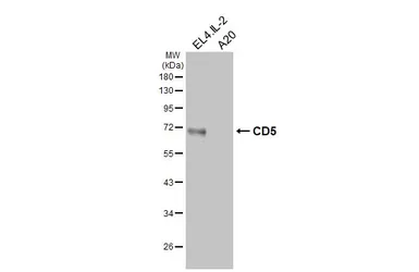 Anti-CD5 antibody [HL6108] used in Western Blot (WB). GTX648193