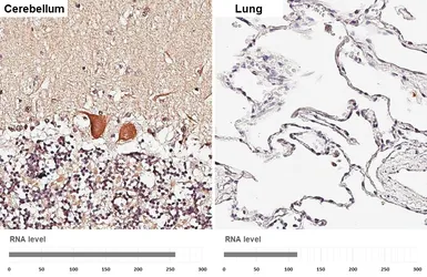 Anti-14-3-3 theta antibody [HL6109] used in IHC (Paraffin sections) (IHC-P). GTX648194