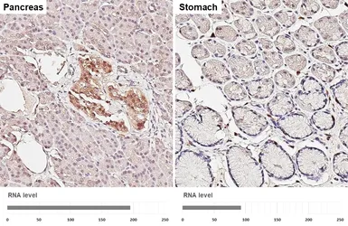 Anti-14-3-3 theta antibody [HL6109] used in IHC (Paraffin sections) (IHC-P). GTX648194