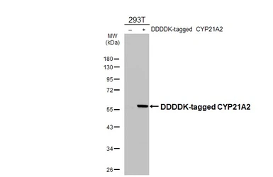Anti-CYP21A2 antibody [HL6128] used in Western Blot (WB). GTX648213