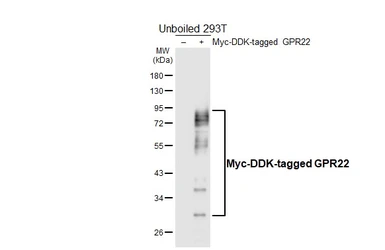 Anti-GPR22 antibody [HL6134] used in Western Blot (WB). GTX648221
