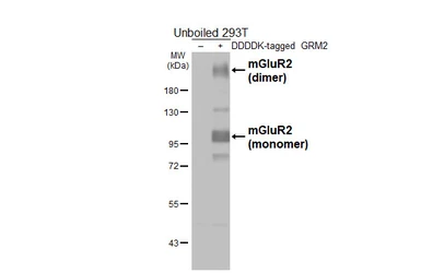 Anti-mGluR2 antibody [HL6151] used in Western Blot (WB). GTX648238