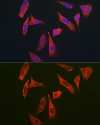 Anti-MYO10 antibody used in Immunocytochemistry/ Immunofluorescence (ICC/IF). GTX64824