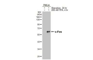Anti-c-Fos antibody [HL6157] used in Western Blot (WB). GTX648244