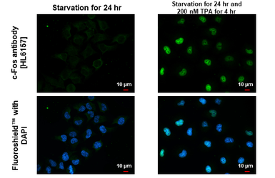 Anti-c-Fos antibody [HL6157] used in Immunocytochemistry/ Immunofluorescence (ICC/IF). GTX648244