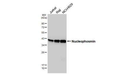 Anti-Nucleophosmin antibody [HL6166] used in Western Blot (WB). GTX648253