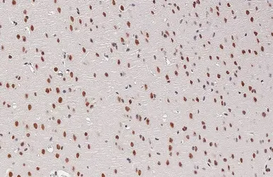 Anti-Nucleophosmin antibody [HL6166] used in IHC (Paraffin sections) (IHC-P). GTX648253