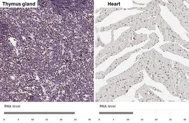 Anti-Nucleophosmin antibody [HL6169] used in IHC (Paraffin sections) (IHC-P). GTX648256