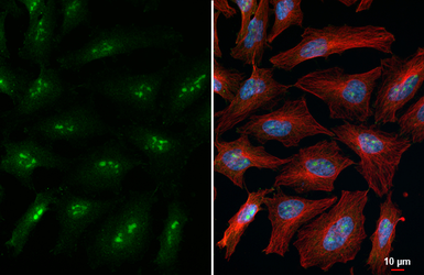 Anti-Nucleophosmin antibody [HL6169] used in Immunocytochemistry/ Immunofluorescence (ICC/IF). GTX648256