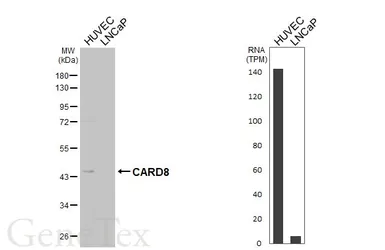 Anti-CARD8 antibody [HL6172] used in Western Blot (WB). GTX648259
