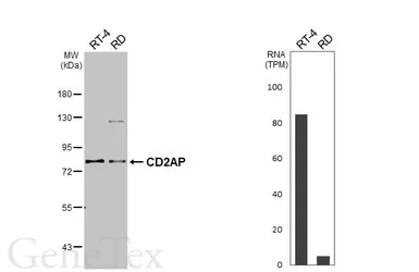 Anti-CD2AP antibody [HL6174] used in Western Blot (WB). GTX648261
