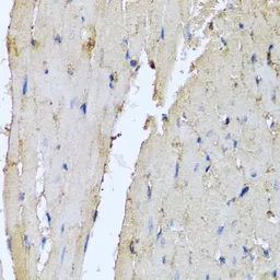 Anti-Defensin alpha 1 antibody used in IHC (Paraffin sections) (IHC-P). GTX64827