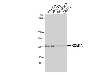 Anti-KDM4A antibody [HL6180] used in Western Blot (WB). GTX648272