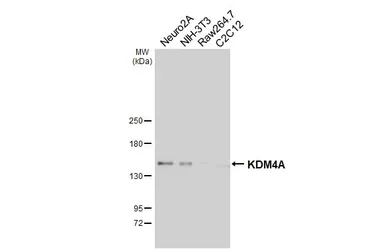 Anti-KDM4A antibody [HL6181] used in Western Blot (WB). GTX648273