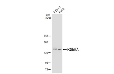 Anti-KDM4A antibody [HL6181] used in Western Blot (WB). GTX648273