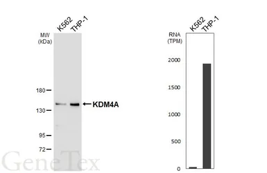 Anti-KDM4A antibody [HL6181] used in Western Blot (WB). GTX648273