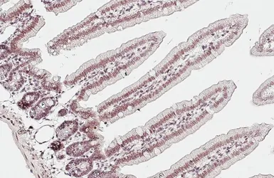 Anti-KDM4A antibody [HL6181] used in IHC (Paraffin sections) (IHC-P). GTX648273