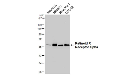 Anti-Retinoid X Receptor alpha antibody [HL6191] used in Western Blot (WB). GTX648283
