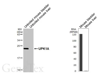 Anti-UPK1A antibody [HL6205] used in Western Blot (WB). GTX648297
