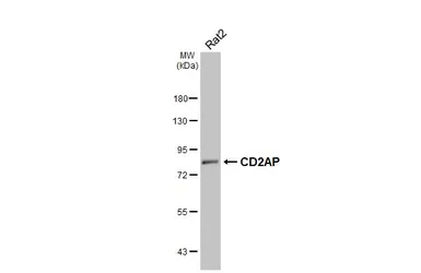 Anti-CD2AP antibody [HL6216] used in Western Blot (WB). GTX648308