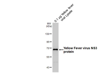 Anti-Yellow Fever virus NS3 protein antibody [HL6232] used in Western Blot (WB). GTX648324
