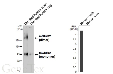 Anti-mGluR2 antibody [HL6234] used in Western Blot (WB). GTX648326