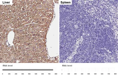 Anti-Aldolase B antibody [HL6238] used in IHC (Paraffin sections) (IHC-P). GTX648330