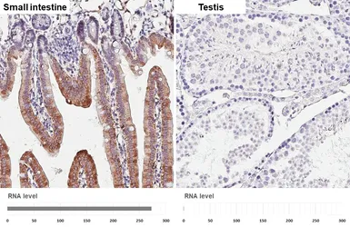 Anti-Aldolase B antibody [HL6238] used in IHC (Paraffin sections) (IHC-P). GTX648330