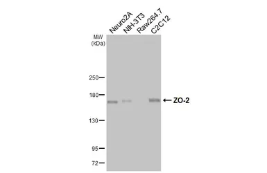 Anti-ZO-2 antibody [HL6245] used in Western Blot (WB). GTX648337