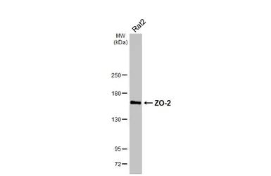 Anti-ZO-2 antibody [HL6245] used in Western Blot (WB). GTX648337