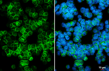 Anti-Integrin alpha 4 antibody [HL6249] used in Immunocytochemistry/ Immunofluorescence (ICC/IF). GTX648341
