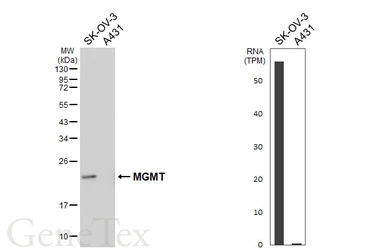 Anti-MGMT antibody [HL6254] used in Western Blot (WB). GTX648346