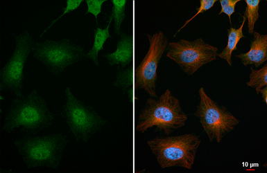 Anti-MGMT antibody [HL6254] used in Immunocytochemistry/ Immunofluorescence (ICC/IF). GTX648346