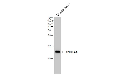 Anti-S100A4 antibody [HL6258] used in Western Blot (WB). GTX648350