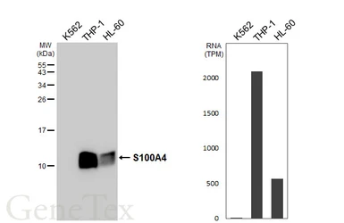 Anti-S100A4 antibody [HL6258] used in Western Blot (WB). GTX648350