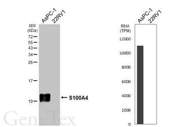 Anti-S100A4 antibody [HL6258] used in Western Blot (WB). GTX648350