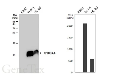 Anti-S100A4 antibody [HL6259] used in Western Blot (WB). GTX648351