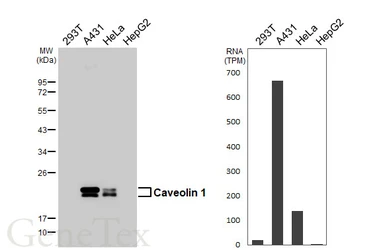 Anti-Caveolin 1 antibody [HL6264] used in Western Blot (WB). GTX648356