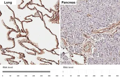 Anti-Caveolin 1 antibody [HL6264] used in IHC (Paraffin sections) (IHC-P). GTX648356