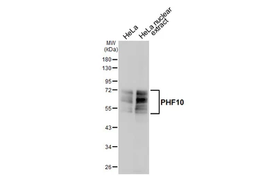 Anti-PHF10 antibody [HL6286] used in Western Blot (WB). GTX648388