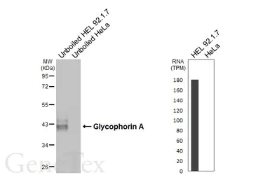Anti-Glycophorin A antibody [HL6300] used in Western Blot (WB). GTX648402