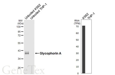 Anti-Glycophorin A antibody [HL6300] used in Western Blot (WB). GTX648402